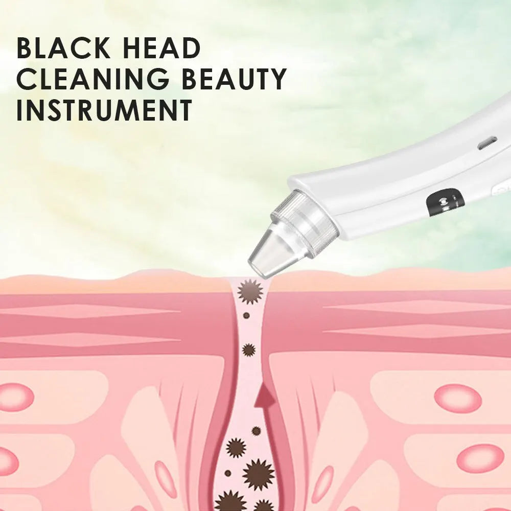 Face Cleansing Beauty Machine Dead Skin Remover Face Vacuum Blackhead Removal Skin