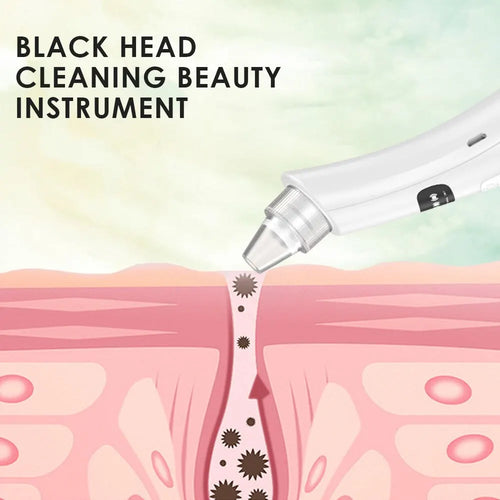 Face Cleansing Beauty Machine Dead Skin Remover Face Vacuum Blackhead Removal Skin