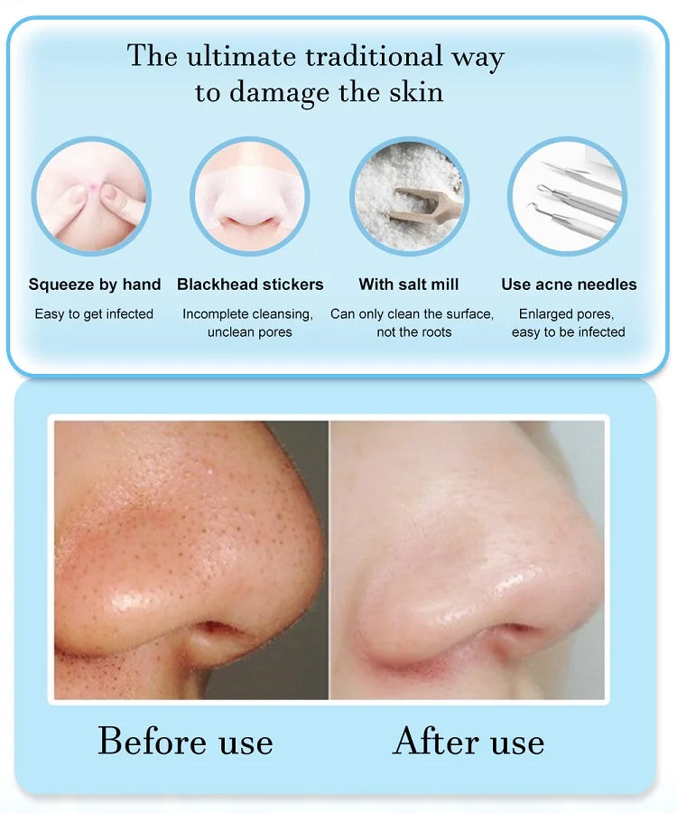 Face Cleansing Beauty Machine Dead Skin Remover Face Vacuum Blackhead Removal Skin